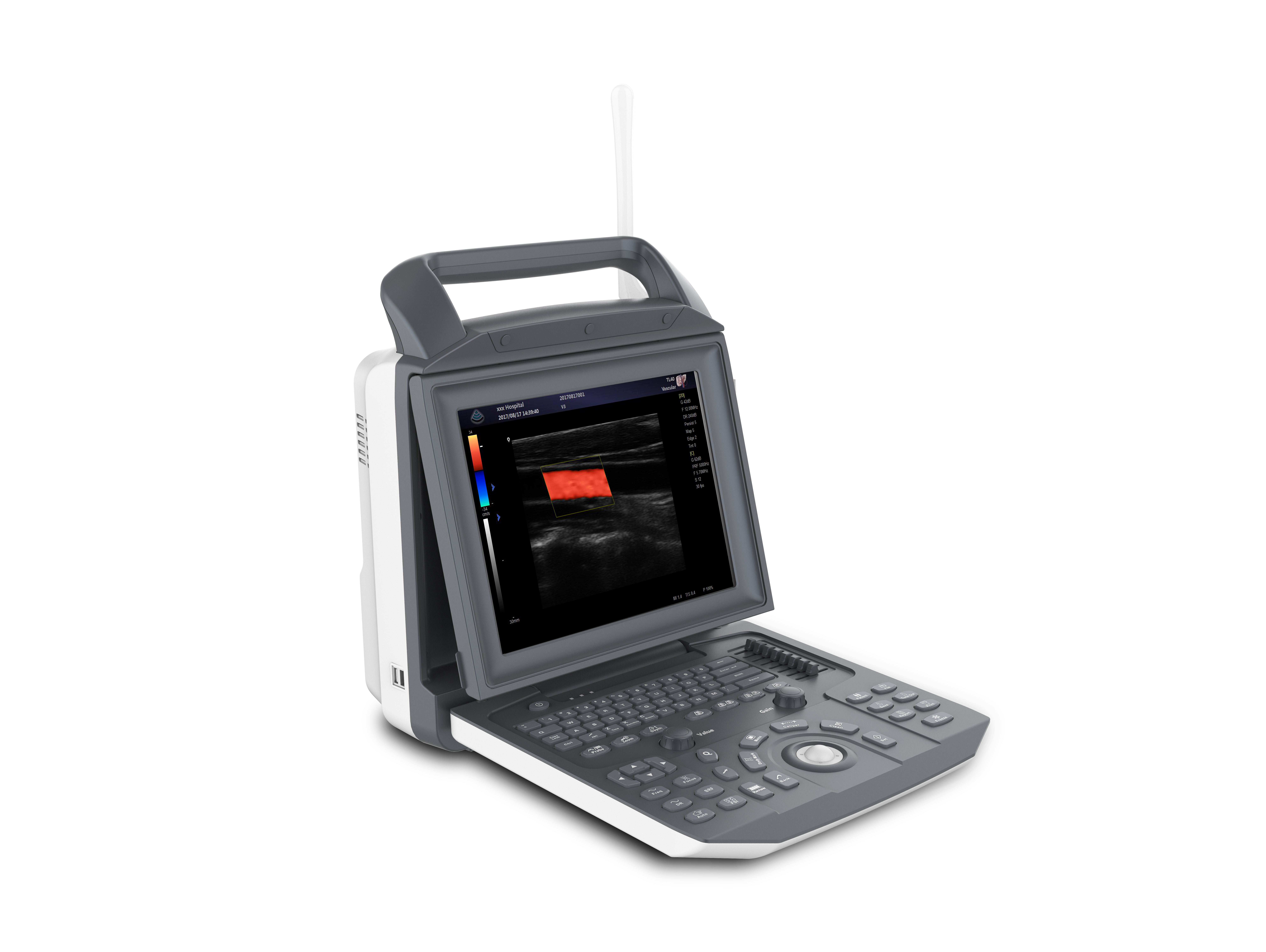 Equipo médico Cardio Técnica